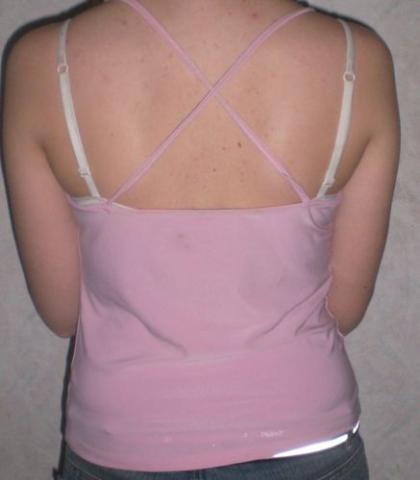 Daiktas rozine bliuskute