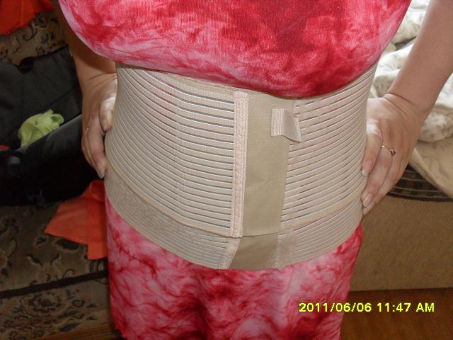 Daiktas Elastinis dirzas po gimdymo