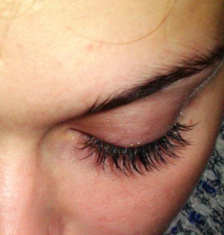 Daiktas blkastienų priauginimas